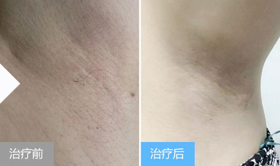 长沙肤康皮肤病医院